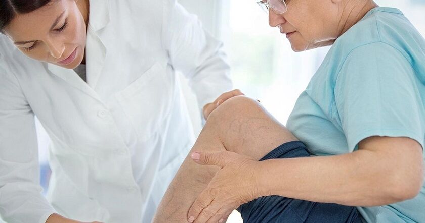 Des varices sont observées à chaque seconde