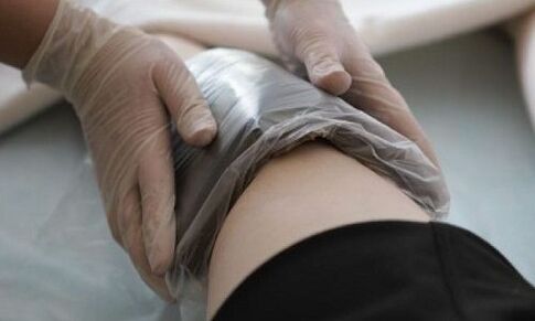 Traitement des varices avec des compresses