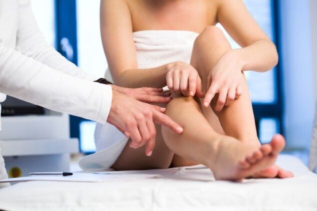 Un médecin examine les jambes à la recherche de varices